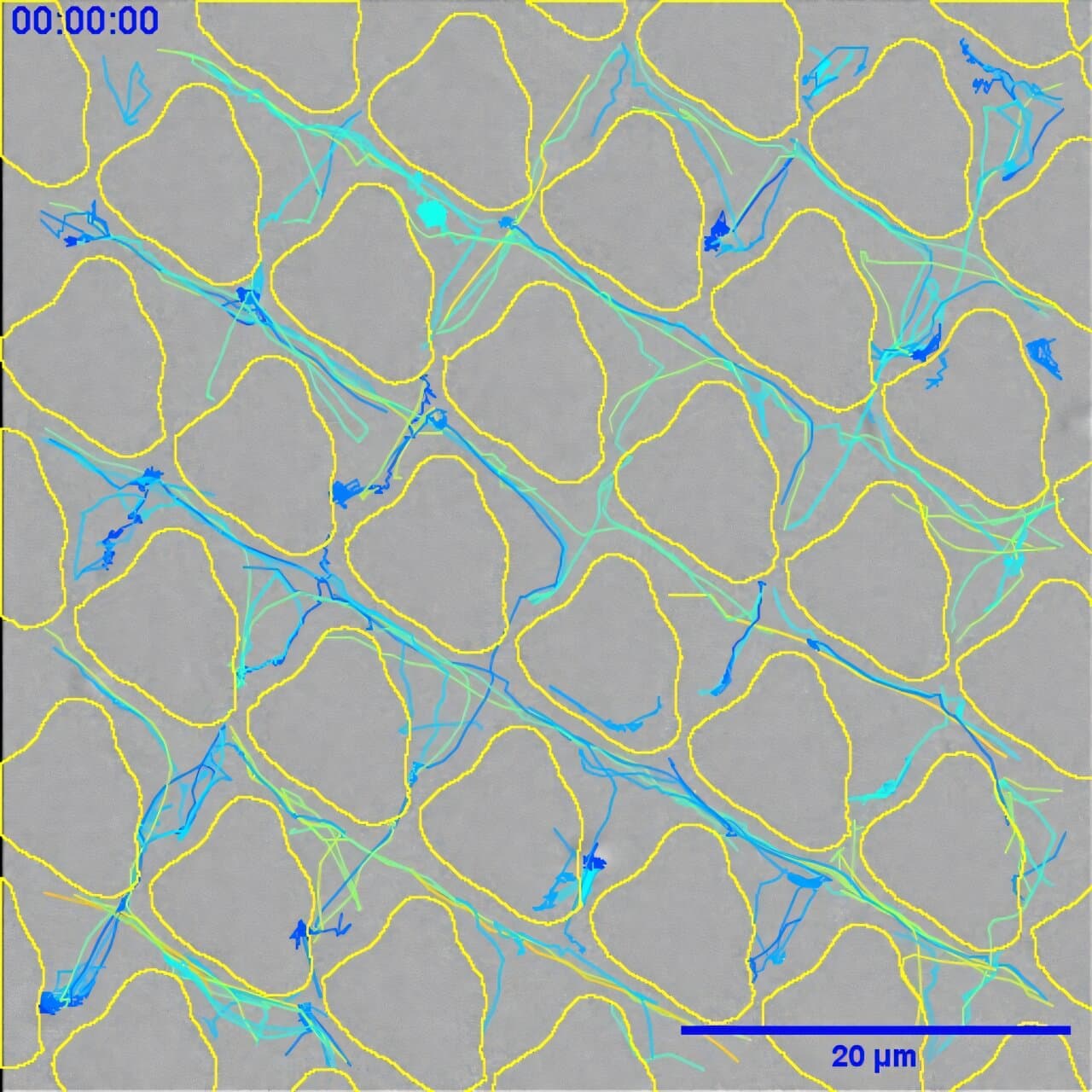Scientists discover a surface pattern that prevents bacterial infections on plastics. - Featured Image