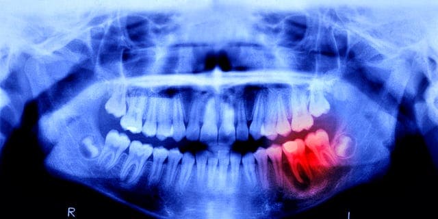 Humans May Be Able to Grow New Teeth Within Just 4 Years - Featured Image
